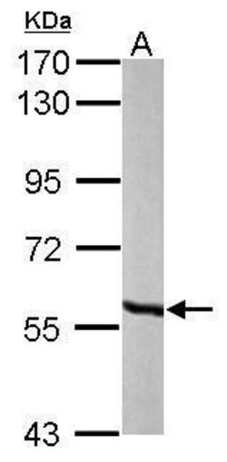 Invitrogen MCCC2 Polyclonal Antibody 100 &mu;L; Unconjugated:Antibodies,