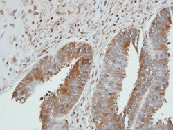 Invitrogen UGP2 Polyclonal Antibody 100 &mu;L; Unconjugated:Antibodies,
