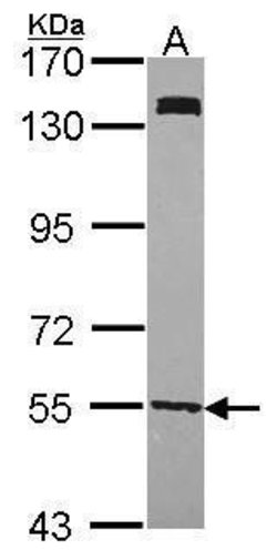 Invitrogen UGP2 Polyclonal Antibody 100 &mu;L; Unconjugated:Antibodies,