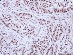 Invitrogen WTAP Polyclonal Antibody 100 &mu;L; Unconjugated:Antibodies,