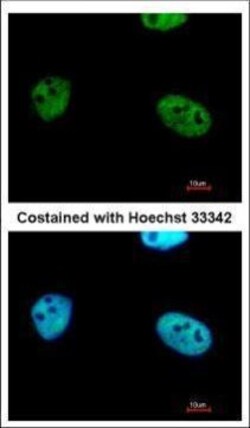 Invitrogen WTAP Polyclonal Antibody 100 &mu;L | Buy Online | Invitrogen&trade; | Fisher Scientific