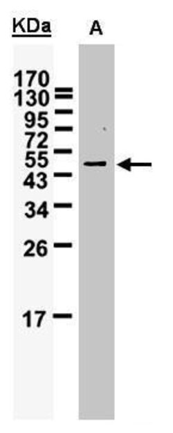 Invitrogen WTAP Polyclonal Antibody 100 &mu;L; Unconjugated:Antibodies,