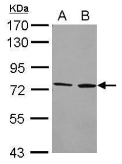 Invitrogen CYP4F2 Polyclonal Antibody 100 &mu;L | Buy Online | Invitrogen&trade; | Fisher Scientific