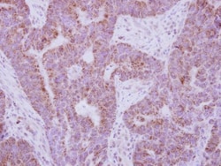 Invitrogen IL10RA Polyclonal Antibody 100 &mu;L; Unconjugated:Antibodies,