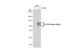 Invitrogen IL10RA Polyclonal Antibody 100 &mu;L; Unconjugated:Antibodies,