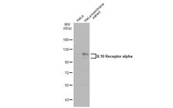 Invitrogen IL10RA Polyclonal Antibody 100 &mu;L; Unconjugated:Antibodies,