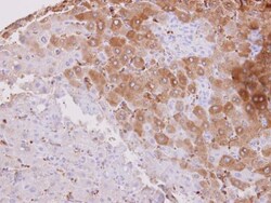 Invitrogen HSD3B2 Polyclonal Antibody 100 &mu;L; Unconjugated:Antibodies,