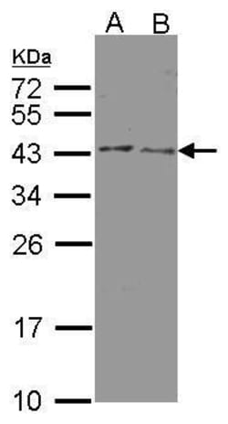 Invitrogen HSD3B2 Polyclonal Antibody 100 &mu;L; Unconjugated:Antibodies,