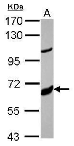 Invitrogen CYP17A1 Polyclonal Antibody 100 &mu;L; Unconjugated:Antibodies,