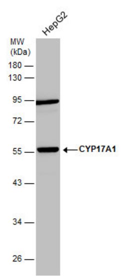Invitrogen CYP17A1 Polyclonal Antibody 100 &mu;L; Unconjugated:Antibodies,
