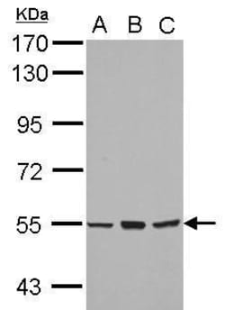Invitrogen CYP4B1 Polyclonal Antibody 100 &mu;L; Unconjugated:Antibodies,