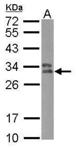 Invitrogen HLA-DPB1 Polyclonal Antibody 100 &mu;L; Unconjugated:Antibodies,