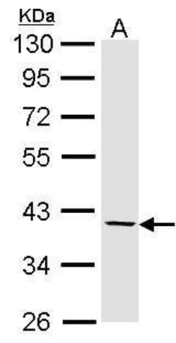 Invitrogen Fibromodulin Polyclonal Antibody 100 &mu;L; Unconjugated:Antibodies,
