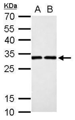 Invitrogen DCK Polyclonal Antibody 100 &mu;L; Unconjugated:Antibodies,