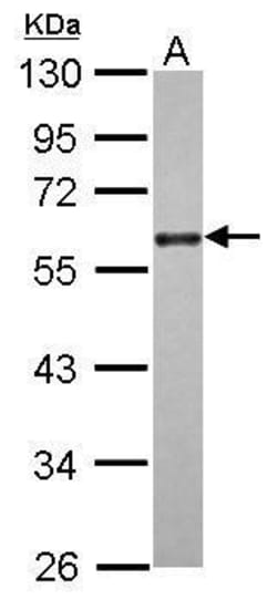 Invitrogen Cdc25C Polyclonal Antibody 100 &mu;L; Unconjugated:Antibodies,