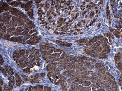 Invitrogen HSD3B2 Polyclonal Antibody 100 &mu;L; Unconjugated:Antibodies,