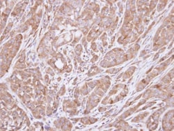 Invitrogen HSD3B2 Polyclonal Antibody 100 &mu;L; Unconjugated:Antibodies,