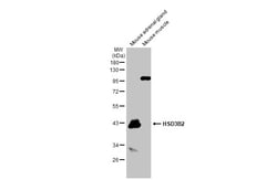 Invitrogen HSD3B2 Polyclonal Antibody 100 &mu;L; Unconjugated:Antibodies,