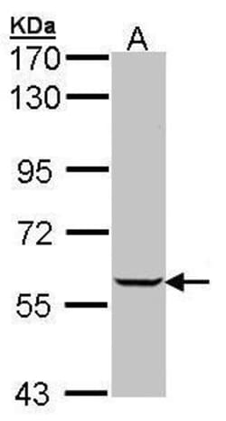 Invitrogen IMPDH1 Polyclonal Antibody 100 &mu;L | Buy Online | Invitrogen&trade; | Fisher Scientific