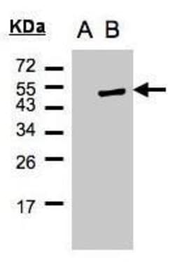 Invitrogen Cytohesin 1 Polyclonal Antibody 100 &mu;L; Unconjugated:Antibodies,