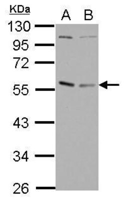 Invitrogen GABPA Polyclonal Antibody 100 &mu;L; Unconjugated:Antibodies,