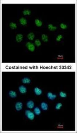 Invitrogen XPC Polyclonal Antibody 100 &mu;L; Unconjugated:Antibodies,
