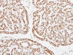 Invitrogen XPC Polyclonal Antibody 100 &mu;L; Unconjugated:Antibodies,