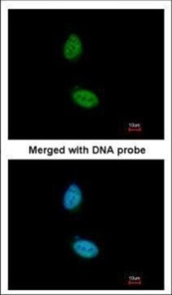 Invitrogen ZNF134 Polyclonal Antibody 100 &mu;L | Buy Online | Invitrogen&trade; | Fisher Scientific