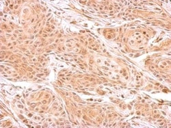 Invitrogen ZNF134 Polyclonal Antibody 100 &mu;L | Buy Online | Invitrogen&trade; | Fisher Scientific