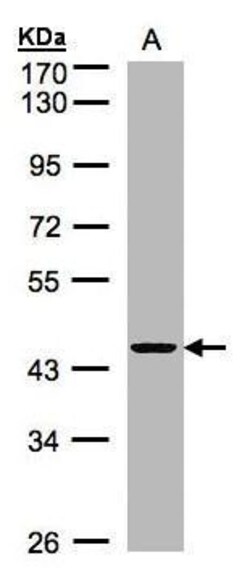 Invitrogen ZNF134 Polyclonal Antibody 100 &mu;L | Buy Online | Invitrogen&trade; | Fisher Scientific
