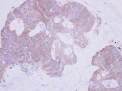 Invitrogen PTER Polyclonal Antibody 100 &mu;L; Unconjugated:Antibodies,
