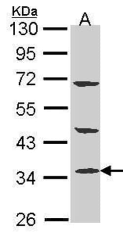 Invitrogen PTER Polyclonal Antibody 100 &mu;L; Unconjugated:Antibodies,