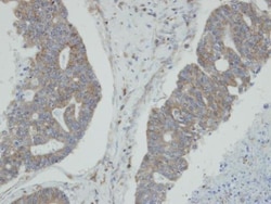 Invitrogen NMI Polyclonal Antibody 100 &mu;L; Unconjugated:Antibodies,