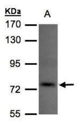 Invitrogen TLK1 Polyclonal Antibody 100 &mu;L; Unconjugated:Antibodies,