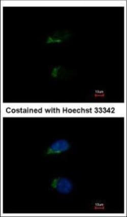 Invitrogen JIK Polyclonal Antibody 100 &mu;L | Buy Online | Invitrogen&trade; | Fisher Scientific