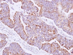 Invitrogen JIK Polyclonal Antibody 100 &mu;L; Unconjugated:Antibodies,