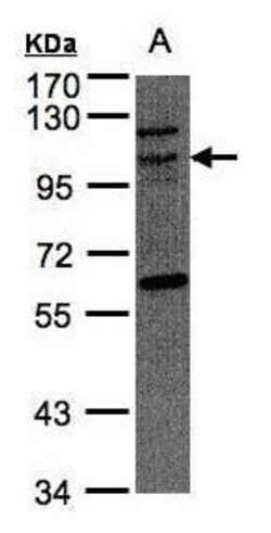 Invitrogen JIK Polyclonal Antibody 100 &mu;L; Unconjugated:Antibodies,
