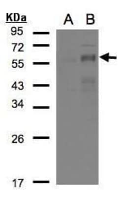Invitrogen EGR2 Polyclonal Antibody 100 &mu;L; Unconjugated:Antibodies,