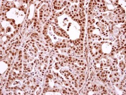 Invitrogen Nuclear Matrix Protein p84 Polyclonal Antibody 100 &mu;L; Unconjugated:Antibodies,