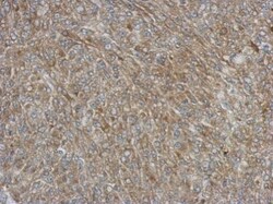 Invitrogen p47phox Polyclonal Antibody 100 &mu;L; Unconjugated:Antibodies,
