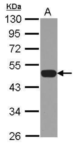 Invitrogen p47phox Polyclonal Antibody 100 &mu;L; Unconjugated:Antibodies,