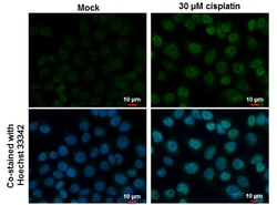 Invitrogen p53 Polyclonal Antibody 100 &mu;L | Buy Online | Invitrogen&trade; | Fisher Scientific