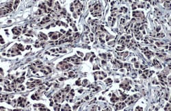 Invitrogen p53 Polyclonal Antibody 100 &mu;L | Buy Online | Invitrogen&trade; | Fisher Scientific