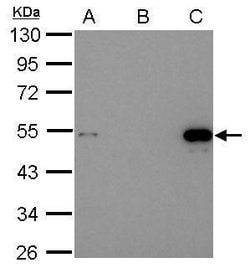 Invitrogen p53 Polyclonal Antibody 100 &mu;L | Buy Online | Invitrogen&trade; | Fisher Scientific