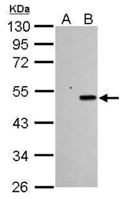 Invitrogen p53 Polyclonal Antibody 100 &mu;L | Buy Online | Invitrogen&trade; | Fisher Scientific