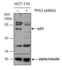 Invitrogen p53 Polyclonal Antibody 100 &mu;L | Buy Online | Invitrogen&trade; | Fisher Scientific