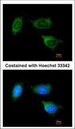 Invitrogen ATP Synthase B1 Polyclonal Antibody 100 &mu;L; Unconjugated:Antibodies,