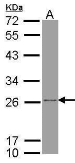 Invitrogen ATP Synthase B1 Polyclonal Antibody 100 &mu;L; Unconjugated:Antibodies,