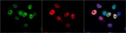 Invitrogen CDK4 Polyclonal Antibody 100 μL; Unconjugated:Antibodies,