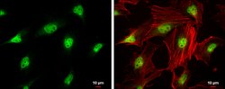 Invitrogen CDK4 Polyclonal Antibody 100 μL; Unconjugated:Antibodies,